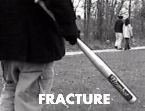 Fracture